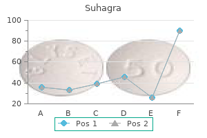 order 100mg suhagra amex