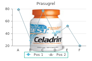 discount prasugrel 10 mg amex