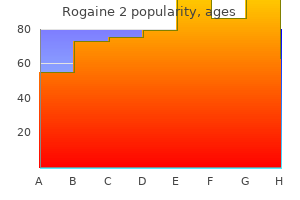 purchase generic rogaine 2 pills