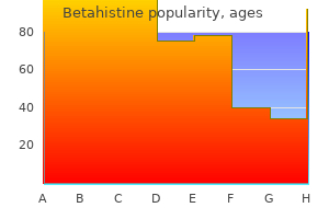 buy betahistine 16mg cheap