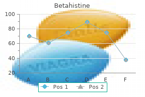 discount 16mg betahistine