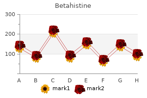 betahistine 16 mg overnight delivery